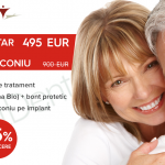 Ce sunt si cand se recomanda fatetele dentare?