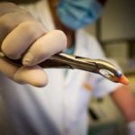 Top 3 lucruri pe care trebuie despre extractii dentare