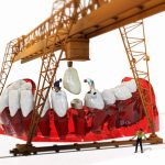 Alimentatia recomandata dupa un implant dentar